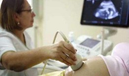 娱乐圈b超单子爆料,明星孕期生活大揭秘