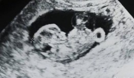 娱乐圈b超单子爆料,明星孕期生活大揭秘