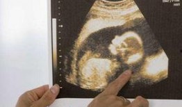 娱乐圈b超单子爆料,明星孕期生活大揭秘